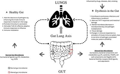 Role of the Microbiome in Interstitial Lung Diseases